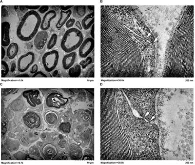 Peripheral Nerve Injury Induces Dynamic Changes of Tight Junction Components